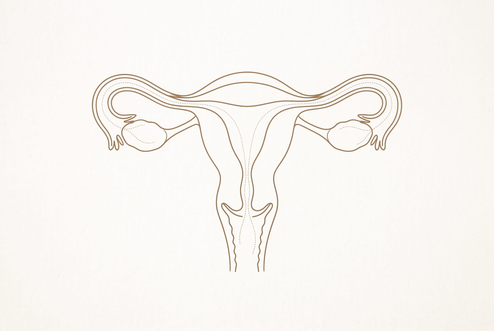 Ilustração do útero e das tubas uterinas, com o trajeto do contraste indicado